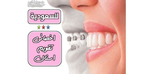 مطلوب اخصائييت تقويم اسنان مصريين للعمل بالسعودية